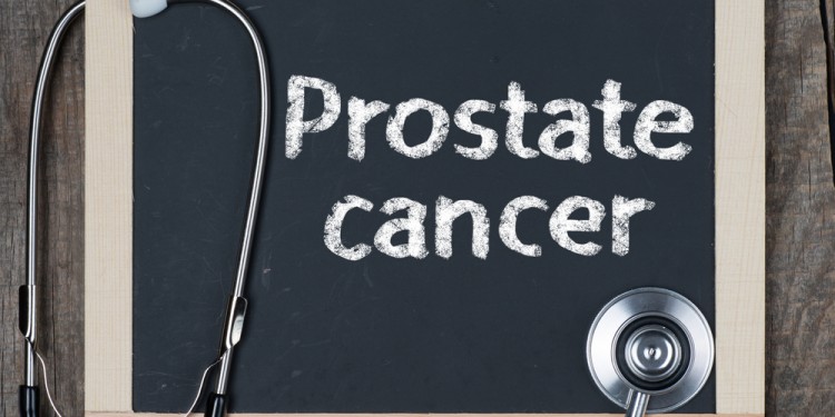 "5 Questions Patients Ask Me About Prostate Cancer" by board-certified urologist Dr. David Hall at MD.com
