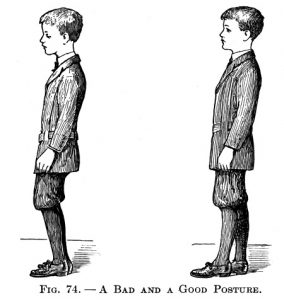 Good vs. Bad Posture 1849 Illustration