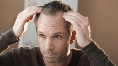 Hair Loss, Hair And Scalp Problems
