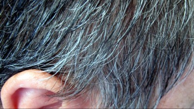 Age, Aging, Hair Loss, Genetics, Hair And Scalp Problems, Looks, Seniors