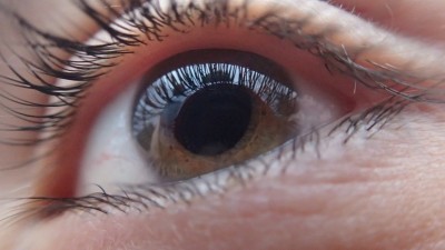 Eye / Vision Problems, Glaucoma