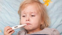 Chickenpox May Lead to Complications