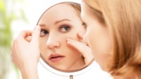 Factors That Can Worsen Acne