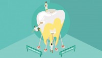 Dental Problems (General), Fears / Phobias